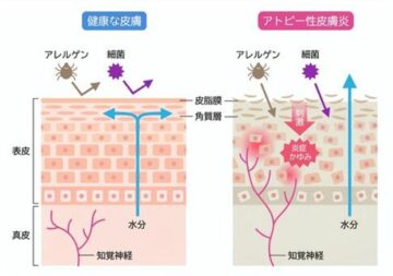 ダメージを受けやすい皮膚